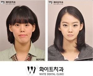 韓国人女性の特徴